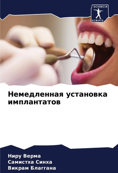 Nemedlennaq Ustanowka Implantatow Niru Verma (U. A.) Taschenbuch Russisch 2023-image