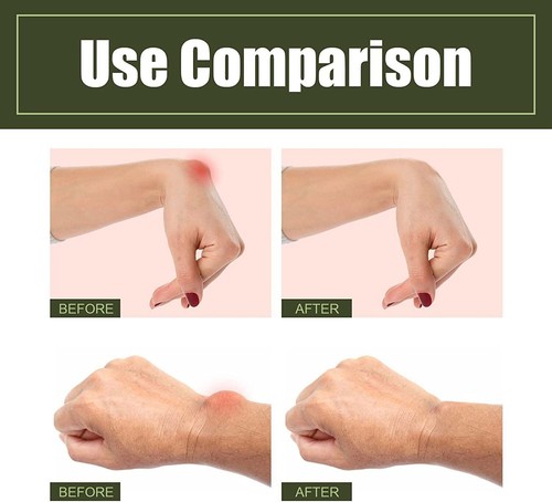 Tendon Sheath Pain and Heel Spray Tenosynovitis Cold Compress Gel - Picture 8 of 12