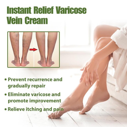 Instant Relief,Varicose Vein Cream 50g Deep Nourishing,Improving Varicose-Veins - Picture 9 of 16