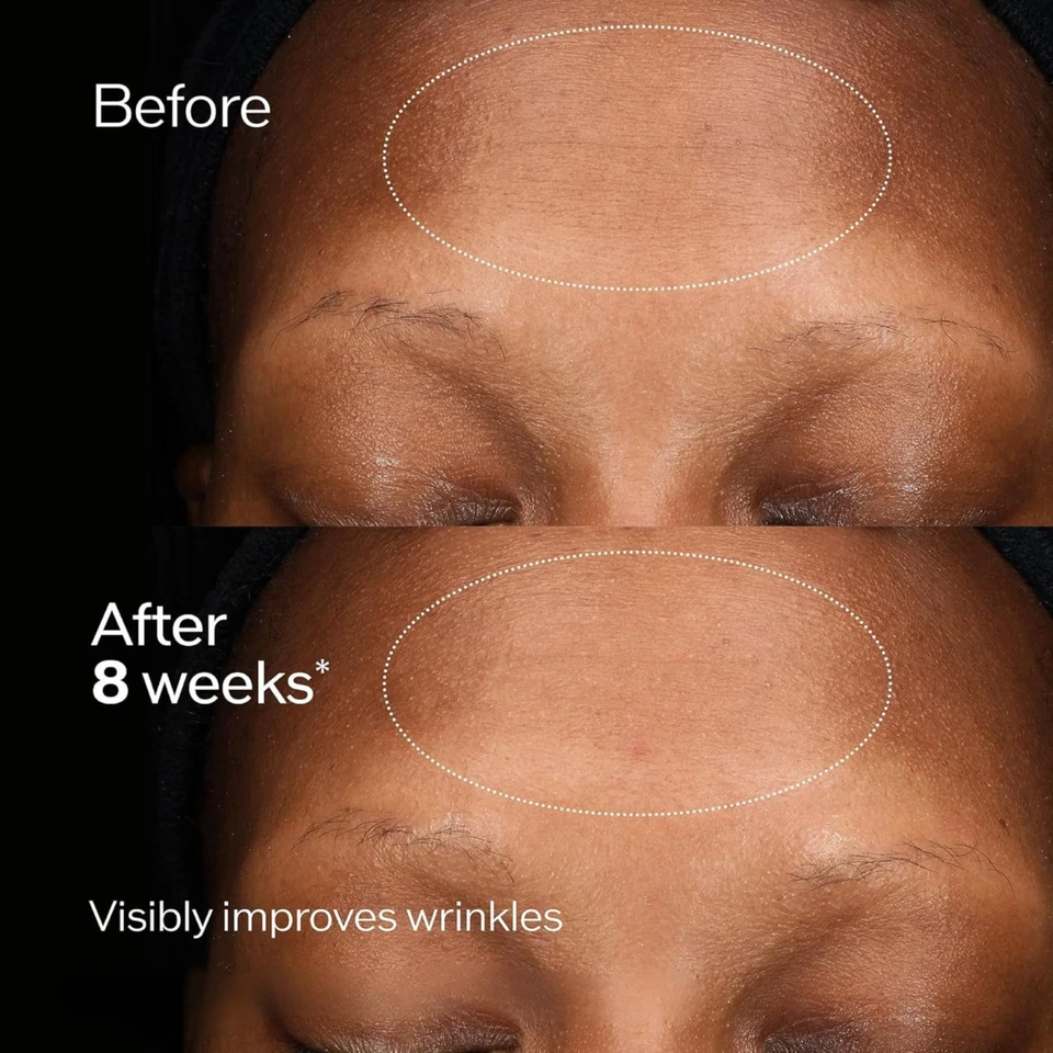 Crema Regeneradora Total Shiseido Future Solution LX 50 ml/1,7 oz. Foto 3 de 4