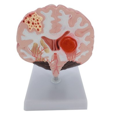 Life Size Brain Anatomical Model Anatomy for Science Classroom Study Teaching