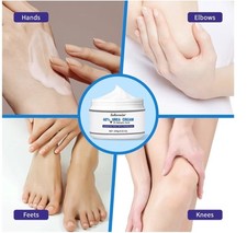 Urea Moisturising Cream Rough Hard Skin Softener Callus Cuticles Knees Feet Hand