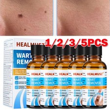 Wart Remover Liquid Skin Tag Mole Remover Eliminate Foot Corn Warts Unisex 30ML