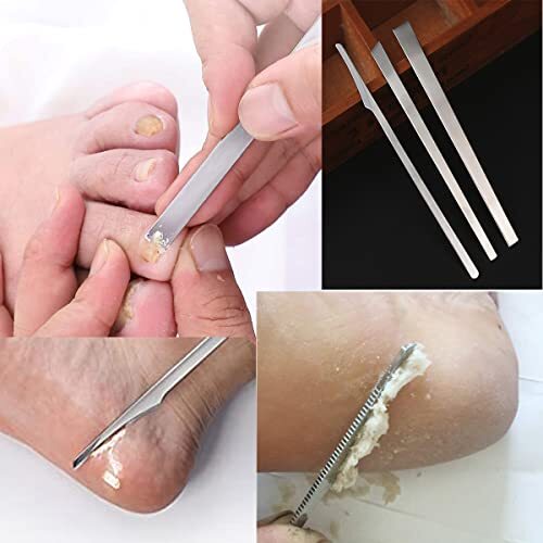 3PCS Stainless Steel ingrown toenail Pedicure Knife Set, Professional Foot - Picture 5 of 7