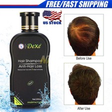 200ml Dexe Hair Shampoo Anti hair Loss Chinese Natural Herbal Hair Growth Unisex