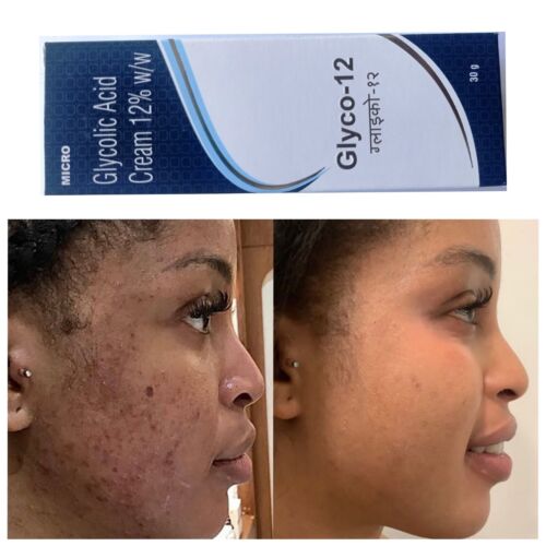 GLYCO 12 Glycolic Acid CREAM 12% Reduce Wrinkles Prevents Acne 30gm Free Shipp - Picture 1 of 3