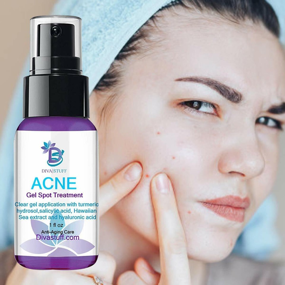 Home Remedy for Cystic Pimple: Your Miraculous Guide to Clearer Skin!