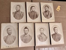 HISTORICALLY SIGNIFICANT CHINESE LEPERS SAN FRANCISCO RARE MEDICINE 19th Century