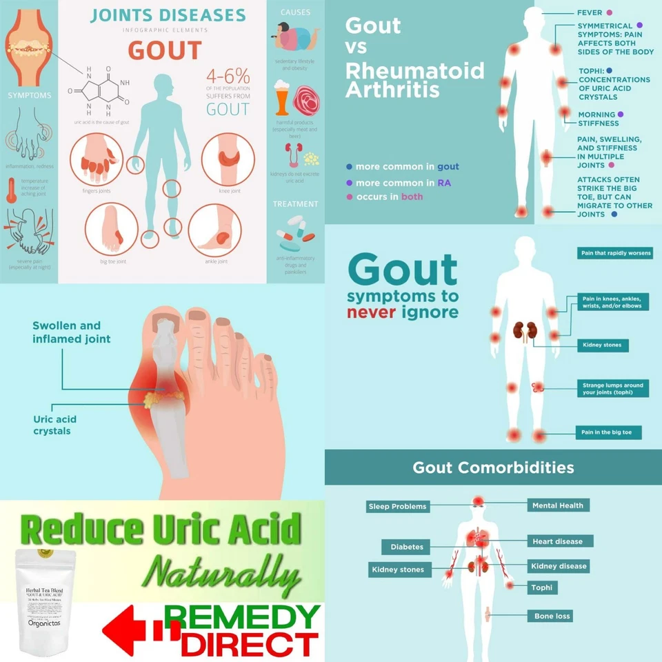 ПОДАГРА средство чай 24 травы подагры травяной чай добавка высокий уровень мочевой кислоты поддержка - Изображение 3 из 4