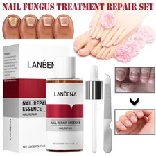 LANBENA Nail Repair Essence Nail Fungus Treatment Natural Nail Toenail Care