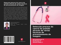 Nirmalakumari K (U. A.) | DetecçãO Precoce Do Cancro Do PulmãO AtravéS De...