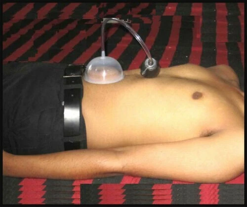 Acupressure Navel / Nabhi Displacement Pump for Surgical Relives Stomach Pain - Picture 1 of 6