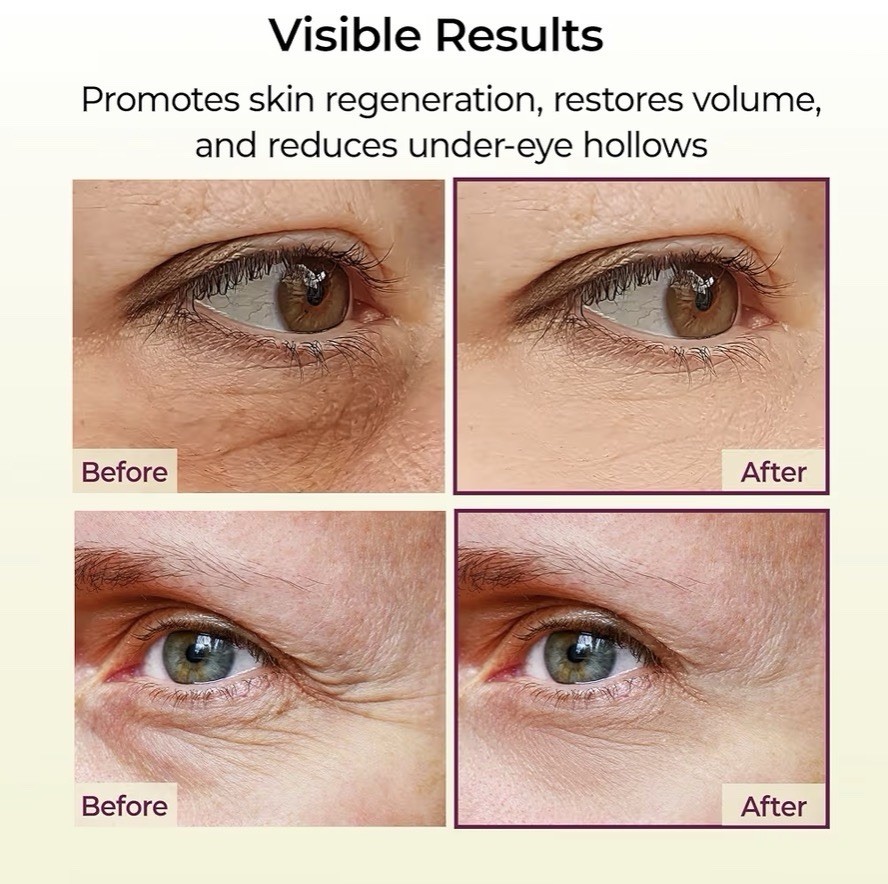 Dr. Melaxin Cemenrete Calcium Volume Multi Balm Wrinkle Core Stick 9g Exp:9/2027