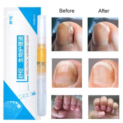 1-4* Anti-Pilz-Hausbehandlung Pen Toe Care Nagelpilz-Behandlung Pen Liquid Best 
