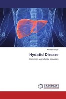 Arvinder Singh | Hydatid Disease | Taschenbuch | Englisch | EAN 9783659437205