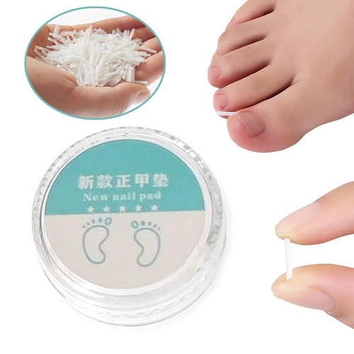 Nail Corrector Ingrown Nail Pad Groove Foot Care Tool Toenail Corrector 50pcs - Picture 5 of 16