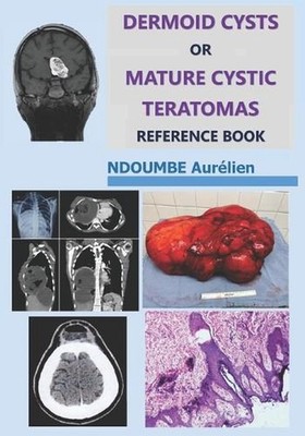 Dermoid Cysts or Mature Cystic Teratomas: Reference Book by Aurelien Ndoumbe Pap