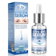 Stye Eye Treatment, Natural Relief Serum for ...