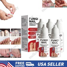 1-5PCS Fungi-Nail Anti-Fungal Liquid Solution Kills Fungus That Can Lead To Nail