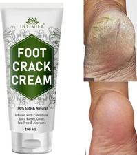foot cream for cracked heels crack heels repair cream for unisex 100ml