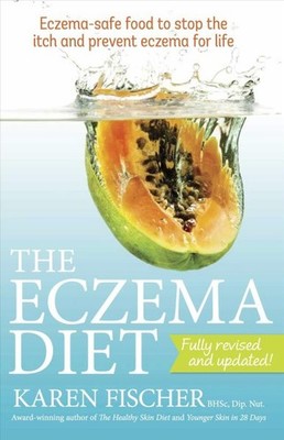 Eczema Diet : Eczema-safe Food to Stop the Itch and Prevent Eczema for Life, ...
