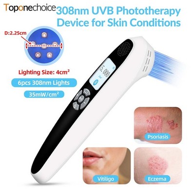 308nm UVB Excimer Phototherapy Light Clinical Grade for Skin Treatment Portable