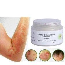 100G COAL TAR & SALICYLIC ACID OINTMENT COSALIC For treating skin PSORIASIS USA