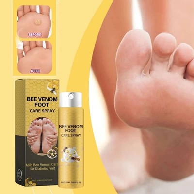 Herbal Bee Venom Foot Care Spray Reduces Swelling Peeling and Cracking of Feet