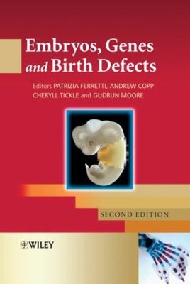 Embryos, Genes and Birth Defects Hardcover