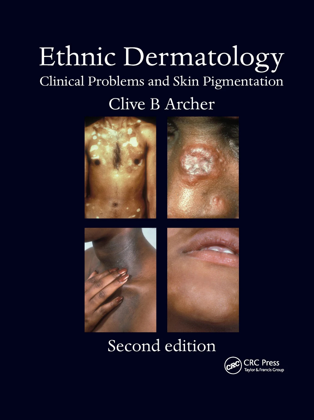 Ethnic Dermatology - 2nd Edition