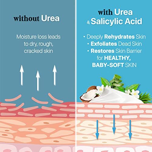 Urea Cream 40% plus Salicylic Acid 4.6 Oz, Callus Remover Hand Cream Foot Cream