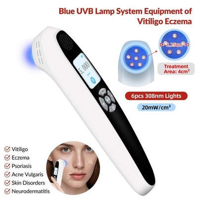 Ultraviolet Light Therapy Equipment 308nm Treatment For Skin Disease 