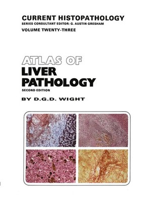 D. G. Wight | Atlas of Liver Pathology | Taschenbuch | Englisch (2012) | 189 S.