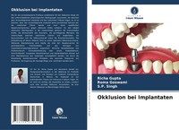 Richa Gupta (U. A.) | Okklusion Bei Implantaten | Taschenbuch | Deutsch (2025)