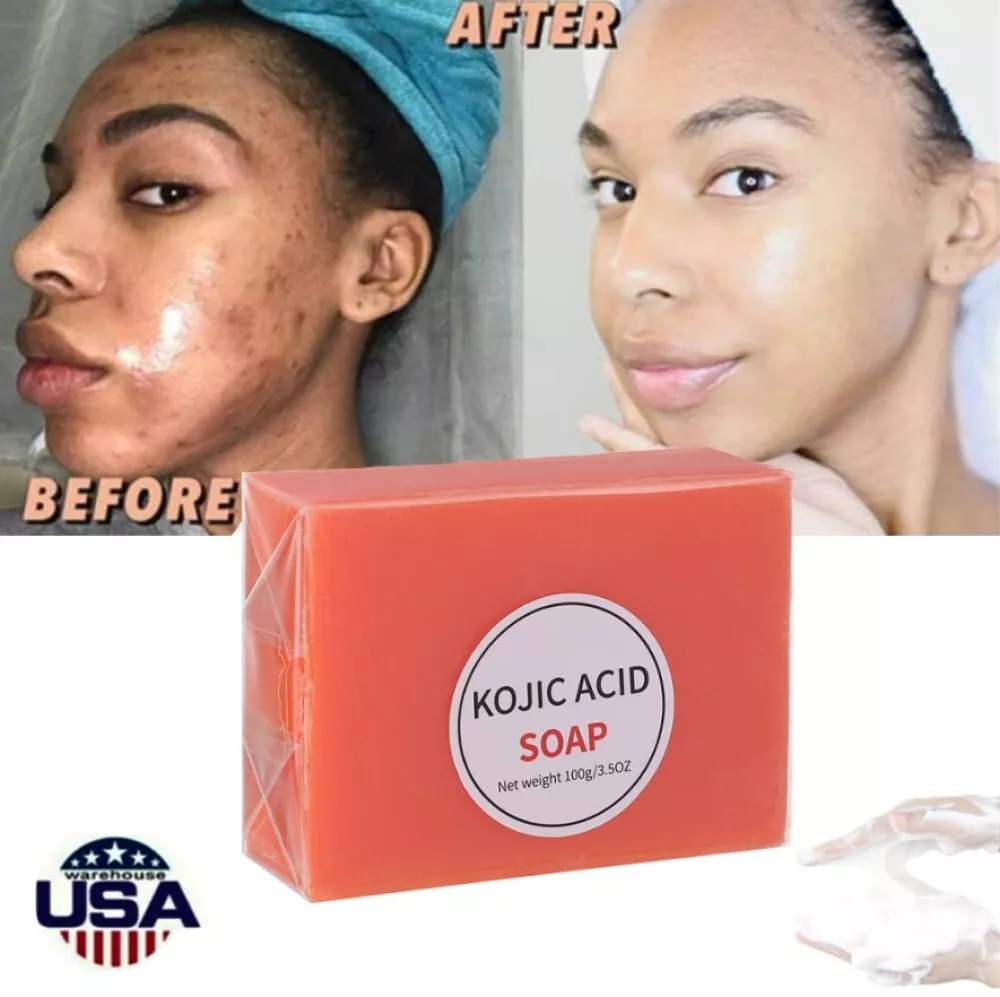 Best skin whitening soap for dark skin deals