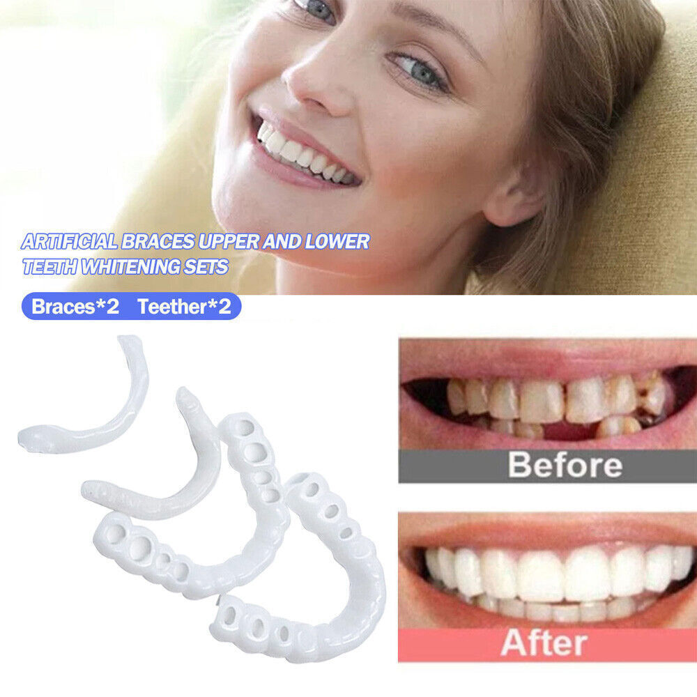 Smile Snap On False Teeth Dental Veneers Denture UK Tooth Cover Upper