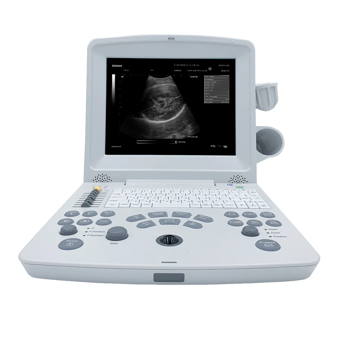 Cardiology Ultrasound Machines