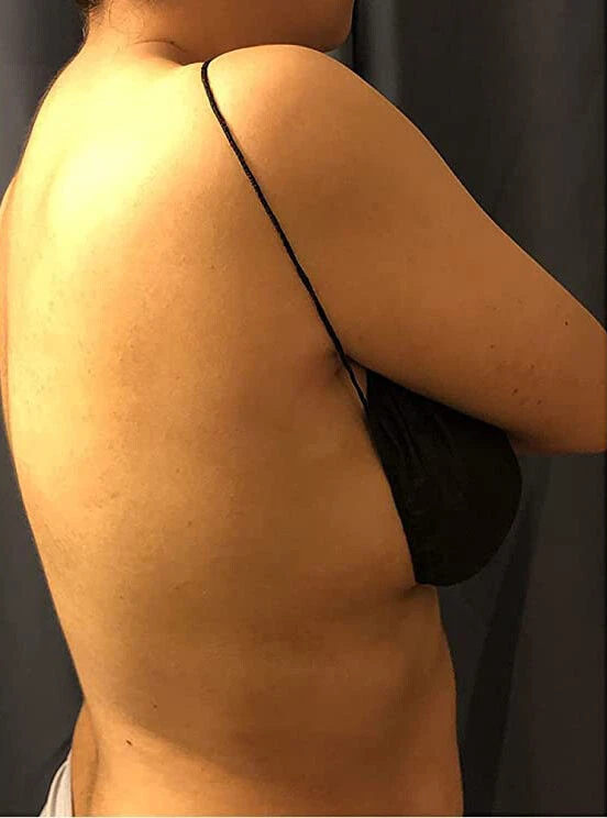 Estuche de 500 sujetadores de bronceado spa desechables negros no tejidos envueltos individualmente