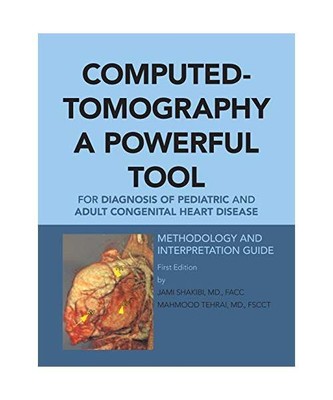 Computed-Tomography a Powerful Tool for Diagnosis of Pediatric and Adult Congeni