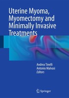 Uterine Myoma, Myomectomy And Minimally Invasive Treatments Antonio Malvasi