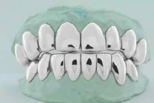 925 Solid Sterling Silver PERM,PERMANENT Cut Custom Fit Grill Grillz