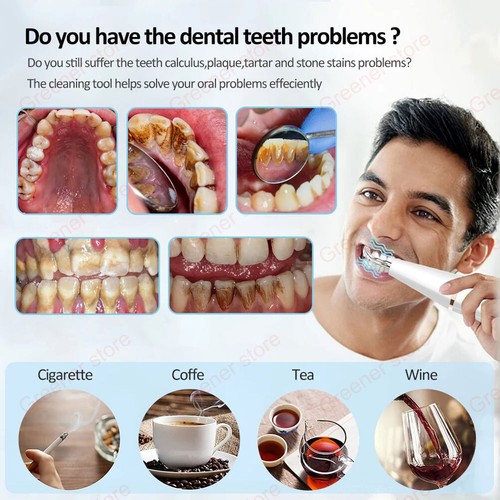 NUEVO Limpiador de dientes ultrasónico escalador dental sarro de dientes kit removedor de placa ST - Imagen 2 de 16