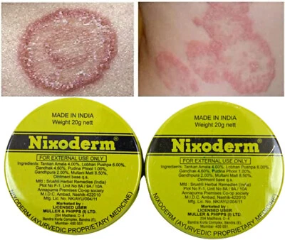 2 x Nixoderm Cream 20g For Skin Problems Eczema Ringworm Blemishes & Pimples