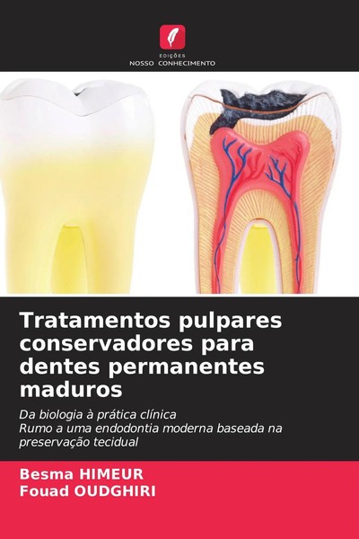 Besma Himeur (U. A.) | Tratamentos Pulpares Conservadores Para Dentes...-image