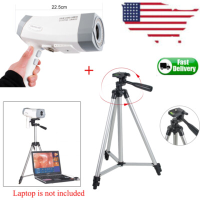 Digital Electronic Colposcope 480000 Pixels Camera Colposcopio +free Tripod