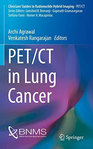 PET/CT in Lung Cancer (Clinicians’ Guides to Radionuclide Hybrid Imaging) - Image 5