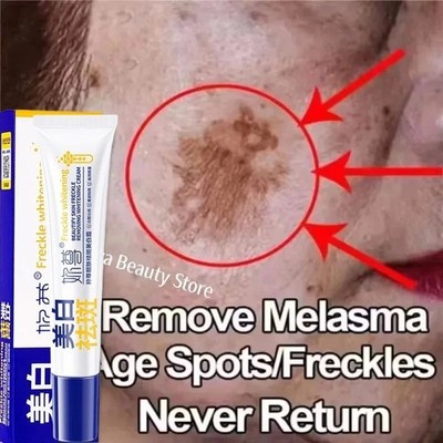 Powerful Spot-Removing Whiten Cream Brighten Skin Fast Eliminates Skin Care