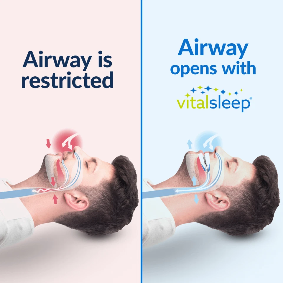 Vital Sleep Stop Snoring Mouthpiece Mouth Guard Stopper - Official Seller - Image 3 of 4