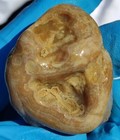 Foto 10 di 11