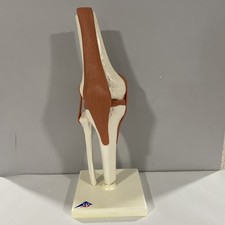 Vintage 2005 3B Scientific Human Knee Joint Model with Ligaments & Cartilage